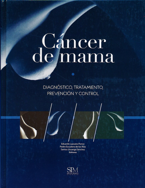Cancer de Mama Diagnostico prevencion y control