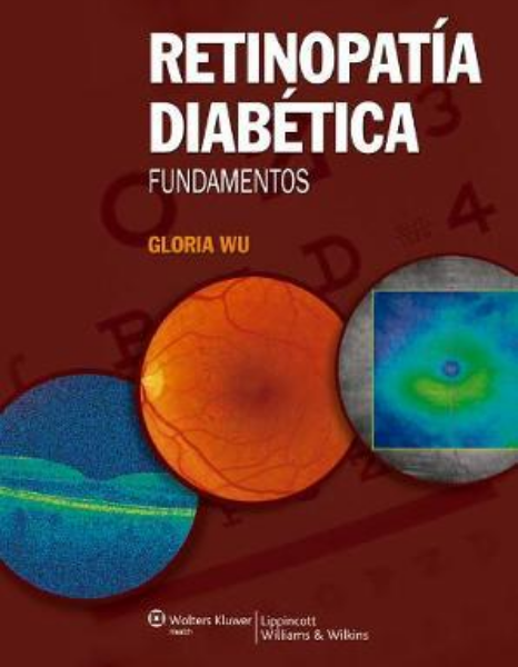 Retinopatía diabética. Fundamentos