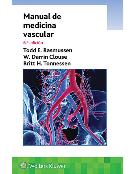 Manual de medicina vascular