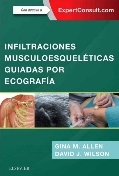 Infiltraciones musculoesqueléticas guiadas por ecografía