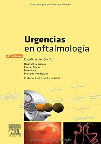 Urgencias en oftalmología