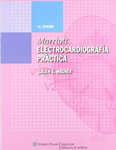 Marriott: Electrocardiografía Practica 