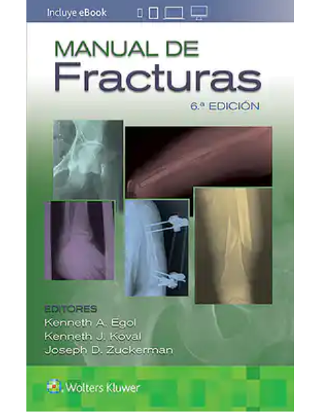 Manual de Fracturas